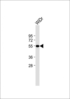 CRTR1 Antibody (N-term)