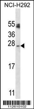 APG10L Antibody (C-term S116)