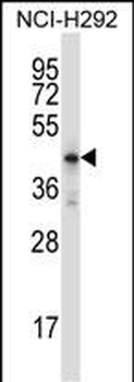 Mouse Hoxd10 Antibody (Center)