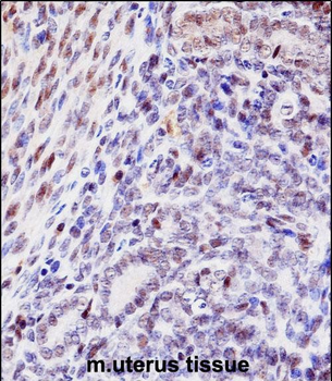 Mouse Hoxd10 Antibody (Center)