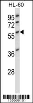 Desmin Antibody (C-term)
