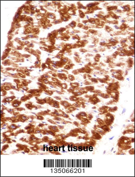 Desmin Antibody (C-term)