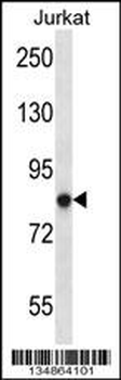 Mouse Prkca Antibody (N-term)