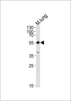 M Mlkl Antibody (C-term)
