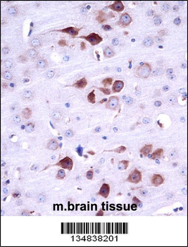 Mouse Matk Antibody (C-term)