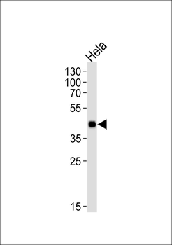 Mouse Mapkapk3 Antibody (N-term)