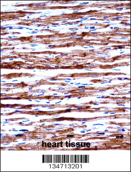 POLR2J Antibody (C-term)