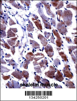DPYSL3 Antibody (C-term)