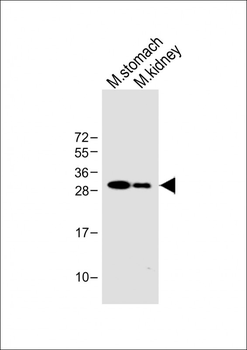 PSCA Antibody (Center)