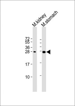 PSCA Antibody (Center)