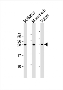 PSCA Antibody (Center)
