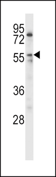 LPL Antibody (Center)