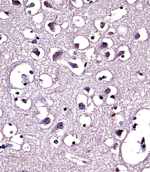 LPL Antibody (Center)