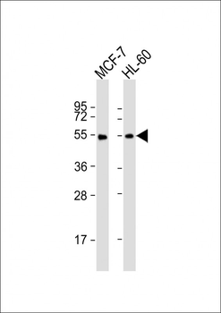LPL Antibody (Center)