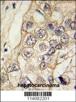 K Cadherin (CDH6) Antibody (C-term)