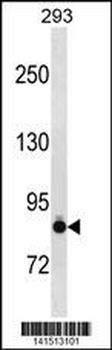 K Cadherin (CDH6) Antibody (N-term)