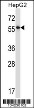 NFIA Antibody (C-term)