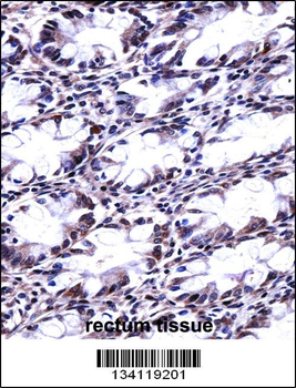CFL2 Antibody (N-term)