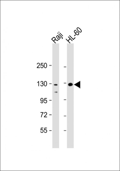 TERT Antibody (S1125)