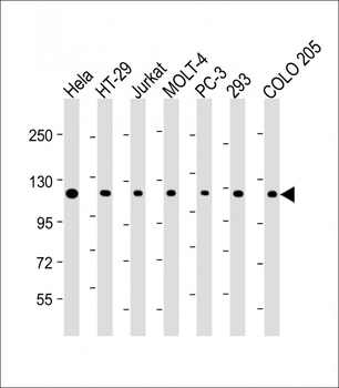 TERT Antibody (Center)