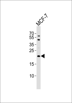 TIMM23 Antibody (C-term)