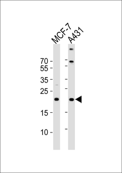 TIMM23 Antibody (C-term)