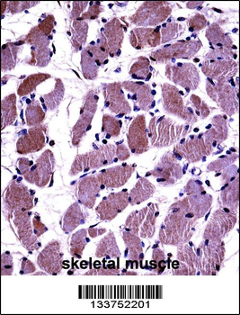 DAG1 Antibody (C-term)