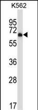 Mouse Dyrk2 Antibody (C-term)