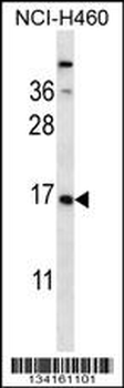 CSRP2 Antibody (Center)
