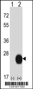 CSRP2 Antibody (Center)