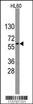 Nucleostemin (GNL3) Antibody (Center)