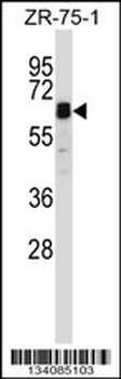 STAM2 Antibody (Center)