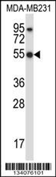 HCLS1 Antibody (C-term)