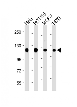 RBBP8 Antibody (C-term)