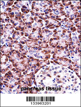 NLRP12 Antibody (N-term)