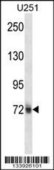 HNRNPM Antibody (N-term)