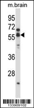 CHRNA5 Antibody (Center)