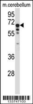 TCF3 Antibody (C-term)