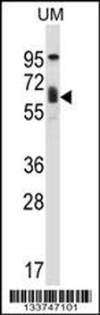 TCF3 Antibody (C-term)