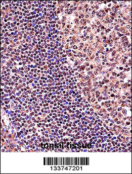 TCF3 Antibody (C-term)