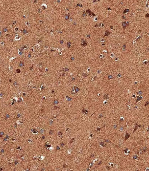 TRPV1 Antibody (N-term)