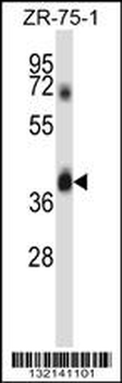 DPAGT1 Antibody (N-term)