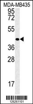 VASH2 Antibody (C-term)