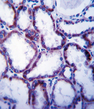 SLC22A1 Antibody (C-term)