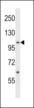 ACK1 Antibody (Center Y284)