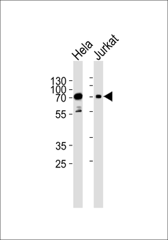 Mouse Pak3 Antibody (N-term)