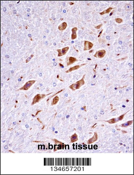 Mouse Pak3 Antibody (N-term)
