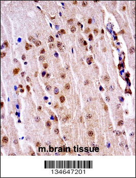 Mouse Nek3 Antibody (C-term)