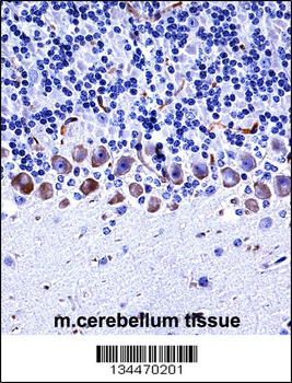 Mouse Epha4 Antibody (Center)