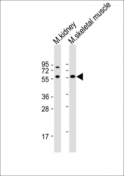 Mouse Acvr2b Antibody (Center)
